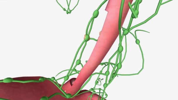 第二阶段包括已发展成为食管主要肌肉层的癌症 — 图库视频影像