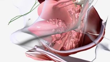 Servikal Kanser Evresi 4, kanserin idrar kesesine ya da rektuma (rektuma) ya da daha uzağa yayıldığı anlamına gelir.