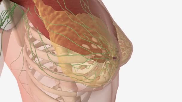 第一阶段乳腺癌3D医学 — 图库视频影像