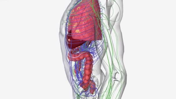 ステージ4結腸がんは最も重大で進行した病期です それは癌が体の他の部分に結腸の外に広がっていることを意味します — ストック動画