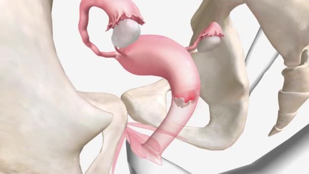 3D骨盤痛と炎症 — ストック動画