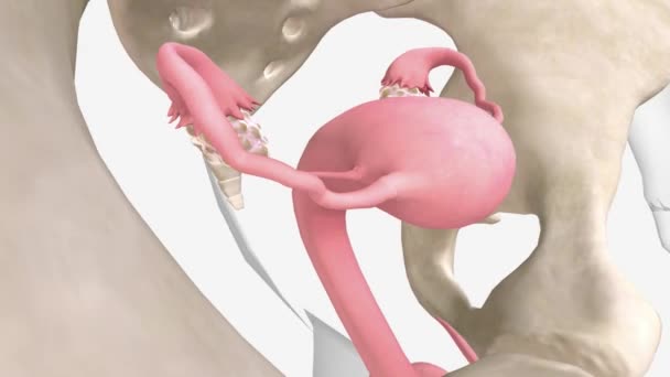 多嚢胞性卵巣症候群は あなたがいくつかの 異常なまたは非常に長い期間を持っている状態です — ストック動画