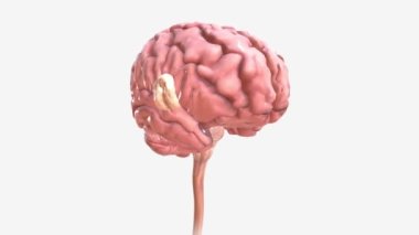 Beyin tümörü, beyinde veya yakınında bulunan hücrelerin büyümesidir.