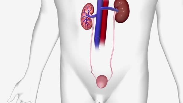 Kidney Cancer Renal Cell Carcinoma Ureter — Stock Video