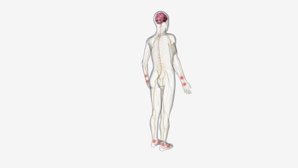 中枢感作 中枢神経系が痛みや他の感覚刺激を処理するプロセス — ストック動画