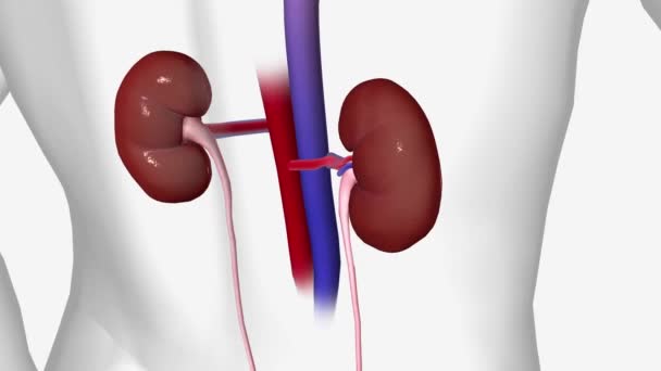 腎臓がん レンタカー細胞がん — ストック動画