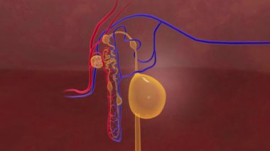 Nephron Kisti 'ndeki Polycystic Böbrek Hastalığı böbrek borusunu tıkıyor
