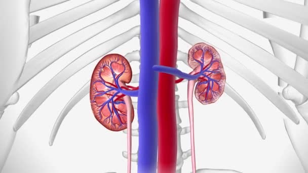 Chronic Kidney Disease Disease Characterized Progressive Damage Loss Function Kidneys — Stock Video