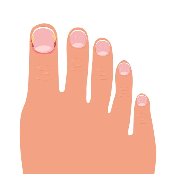 Ноги Красивым Педикюром Ухоженные Ногти Французский Вектор Концепции Педикюра Иллюстрация — стоковый вектор