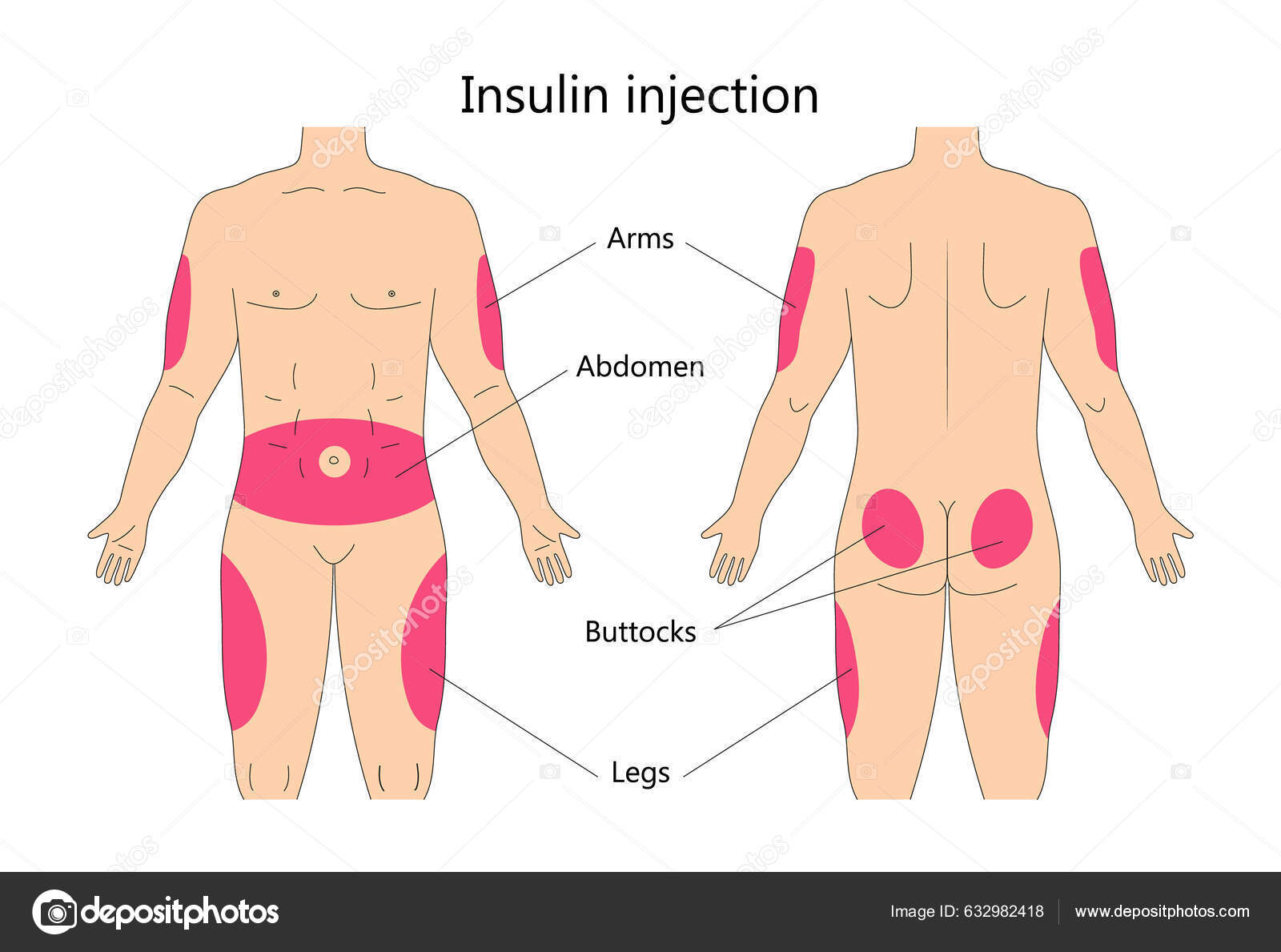 Illustration de Insuline Injection Vecteur Infographique Traitement