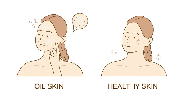 Acne Skin Black Dots Face Pimples Acne Teenager Skin Girl — Stock Vector