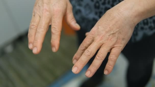 Primer Plano Mujer Anciana Paciente Parkinson Estrechando Las Manos Atención — Vídeos de Stock