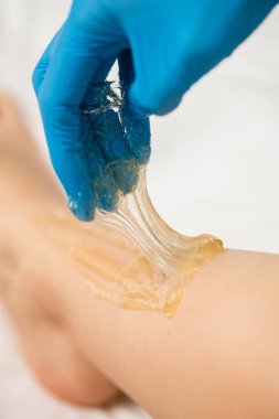 Epilasyonla kadın bacağında tüy çıkarma işlemi. Beyaz arkaplan.