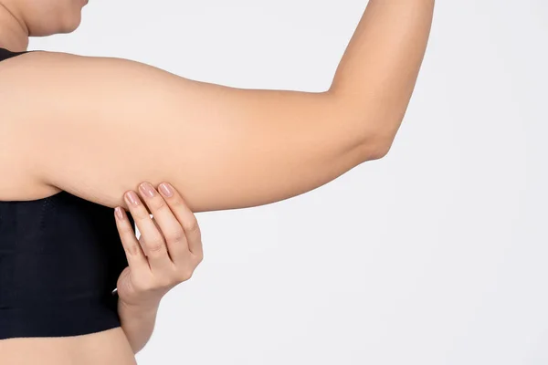 Photo of excess fat on the arm of a woman. Plastic surgery.