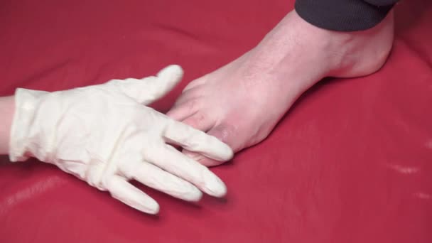 Руки Доктора Перчатках Наносят Мазь Поврежденный Палец Ноги Пациента — стоковое видео