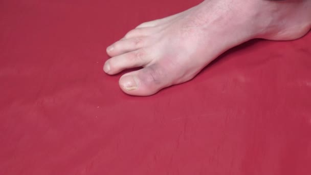 Doctor Examines Sore Toe Patient — Stok video
