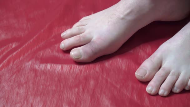 白い手袋の医者は患者の足のつま先の痛みを調べる — ストック動画