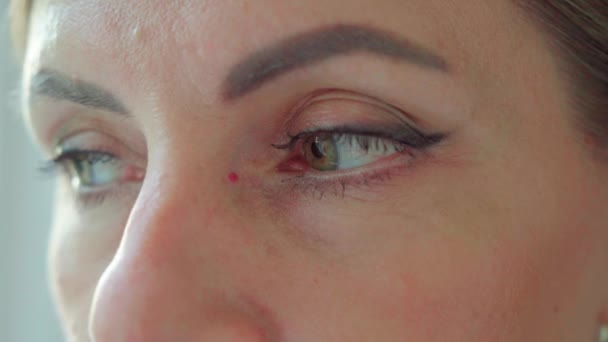 Zmęczone Zapalne Oczy Kobiety Która Pracowała Przy Komputerze Przez Długi — Wideo stockowe
