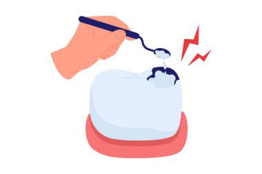 Diş Doldurma Prosedürü ve Cavity Tedavi. Diş Hekimi Ağız Sağlığı İçin Çürük Diş Tamiri