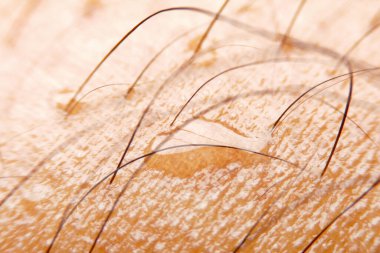 Egzersiz sonrası deriye yakın çekim teri.