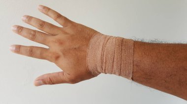 Bilek yaralanması De quervain hastalığı, bilekteki tendonları etkileyen acı verici bir durum. 