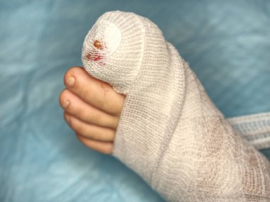 Isırılan kurbanın bacağı beyaz steril bandajla bağlanmış. Ayak parmaklarında kan var..