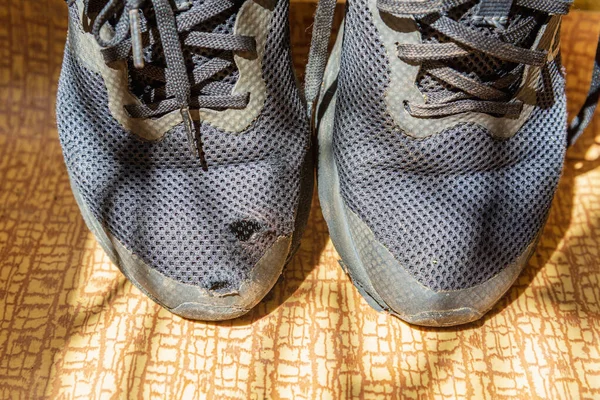 Sapatilhas Sapatos Com Buracos Them Homeless Criança Pobre Shoes Closeup — Fotografia de Stock