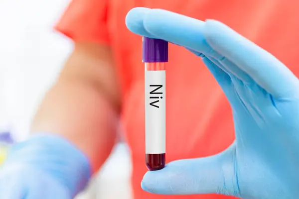 Blood sample tube for Nipah Virus test.Blood sample tube for Nipah virus NiV RT- PCR test.Doctor woman holding a glass test tube. Nipah Henipavirus concept.