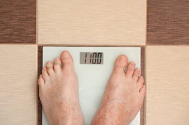 Aşırı kilolu ve obezite problemleri. Fazladan ağırlığı ve elektronik ağırlığı olan insan ayakları vücut ağırlığını gösterir.