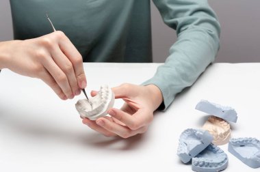 Çıkarılabilir çene alçı prototipleri oluşturma süreci