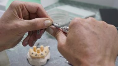 Diş Laboratuvarında Zirkonyum porseleni ve implant çalışmaları