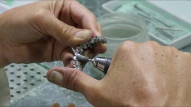 Diş Laboratuvarında Zirkonyum porseleni ve implant çalışmaları