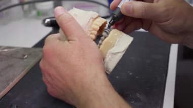 Diş Laboratuvarında Zirkonyum porseleni ve implant çalışmaları