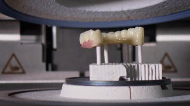 Diş Laboratuvarında Zirkonyum porseleni ve implant çalışmaları