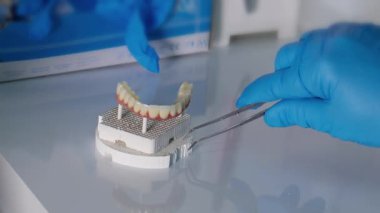 Diş Laboratuvarında Zirkonyum porseleni ve implant çalışmaları