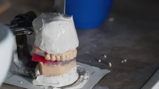 Zirconium Porcelain Implant Studies Dental Laboratory — Stok video