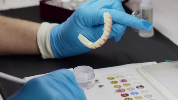 Zircônio Porcelana Estudos Implantes Laboratório Dental — Vídeo de Stock