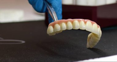 Diş Laboratuvarında Zirkonyum porseleni ve implant çalışmaları 