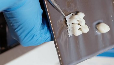 Diş Laboratuvarında Zirkonyum porseleni ve implant çalışmaları 