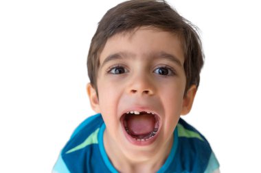 Diş bakımı konsepti. Diş tasviri. Çürük ya da çatlaklardan etkilenen çocukların dişlerini onarmak için kullanılan gümüş kaplama. Gümüş çelik taç. Gülümse, dişsiz çocuk..