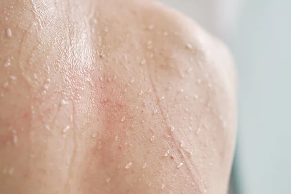 Water Drops Skin Close Shot Naked Female Body Skin Water — Stock Photo, Image