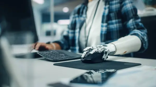 Inclusive Office Person Disability Using Prosthetic Arm Work Computer Professional — Stock Photo, Image