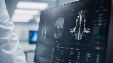 Tıp Hastanesi: Nörolog ve Nöroşirürji Uzmanı, Bilgisayar Kullan, Hasta MRI taraması yap, Beyin Teşhisi koy. Beyin Cerrahisi Sağlık Kliniği: İki