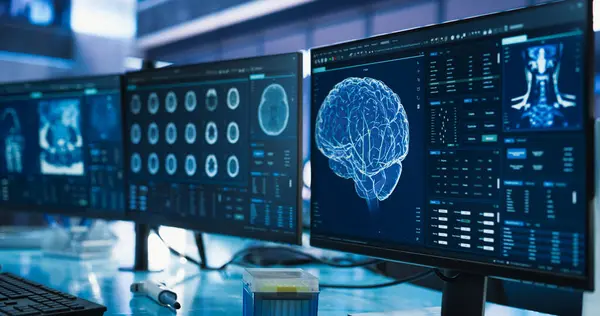 stock image Cancer Research Center Medical Laboratory: Close Up of a Set of Desktop Computer Monitors Showing CT Scans Of Human Brain. Specialist Studying Brain