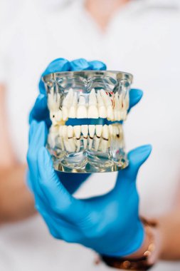 Cerrahın elindeki çenenin diş tanıtım modeli.