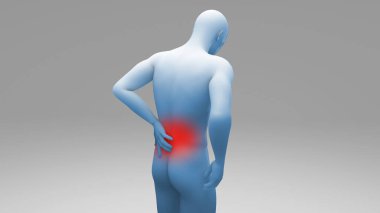Kırmızı Zonklayan Belaltı Ağrısı 3B Canlandırma