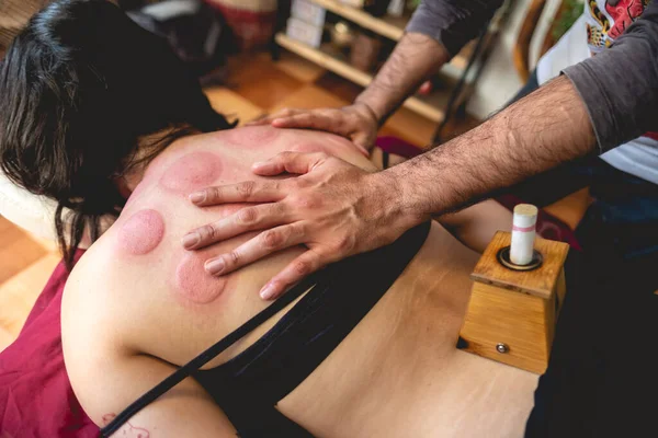 Traditionele Chinese Arts Het Consult Doet Een Massage Een Cupping — Stockfoto