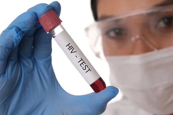 Laboratory worker with an HIV test.
