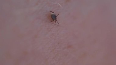 Deride kene kaynaklı beyin iltihabı ya da Lyme hastalığı gibi tehlikeli hastalıklara yol açan bir kene..