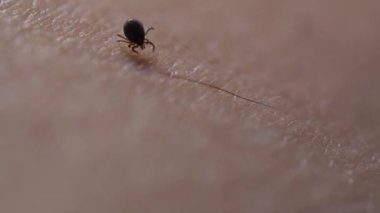 Deride kene kaynaklı beyin iltihabı ya da Lyme hastalığı gibi tehlikeli hastalıklara yol açan bir kene..